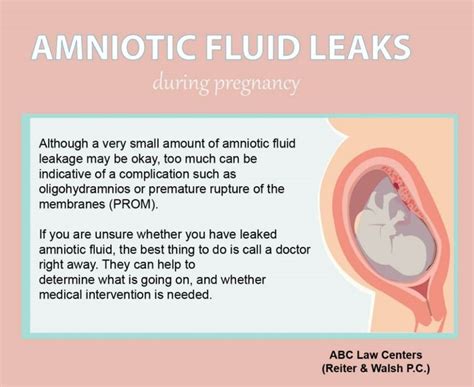 symptoms of leaking amniotic fluid|Leaking Amniotic Fluid: Signs, Causes, and。